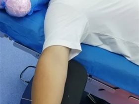 平衡针灸针麻下切除皮脂腺囊肿