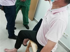 桡骨骨折平衡针麻下实施手法复位术