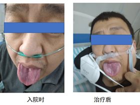 苁蓉当归 | “针药”再显奇效，隔离病区重症新冠患者转危为安