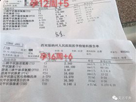 庆祝建党100周年：来自西双版纳傣族医生鄢宗东的《平衡针为孕期保驾护航》临床报告