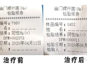 生命健康卫士：高志阳平衡针脑技术14次干预幽门螺杆菌指标正常
