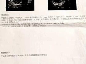 社区健康卫士：平衡针灸创始人王文远教授亲传弟子张燕斌运用平衡针干预卵巢囊肿、子宫肌瘤、甲状腺囊腺瘤一例